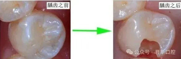 68d4f09bc85b5.jpg 塞牙也是一种病-1.jpg