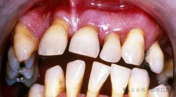 68d4f0c57e92a.jpg 塞牙也是一种病-2.jpg