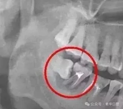 68d4f0e3198cf.jpg 塞牙也是一种病-3.jpg